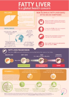 Fatty liver is a global health concern